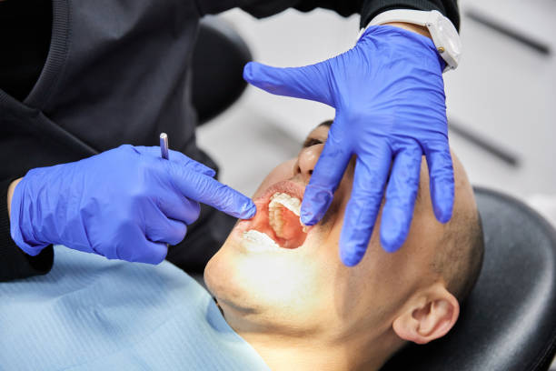 Best Emergency Root Canal Treatment in Munising, MI