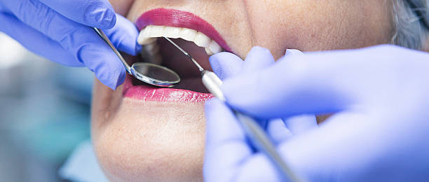 Best Emergency Treatment for Dental Infections or Abscesses in Munising, MI